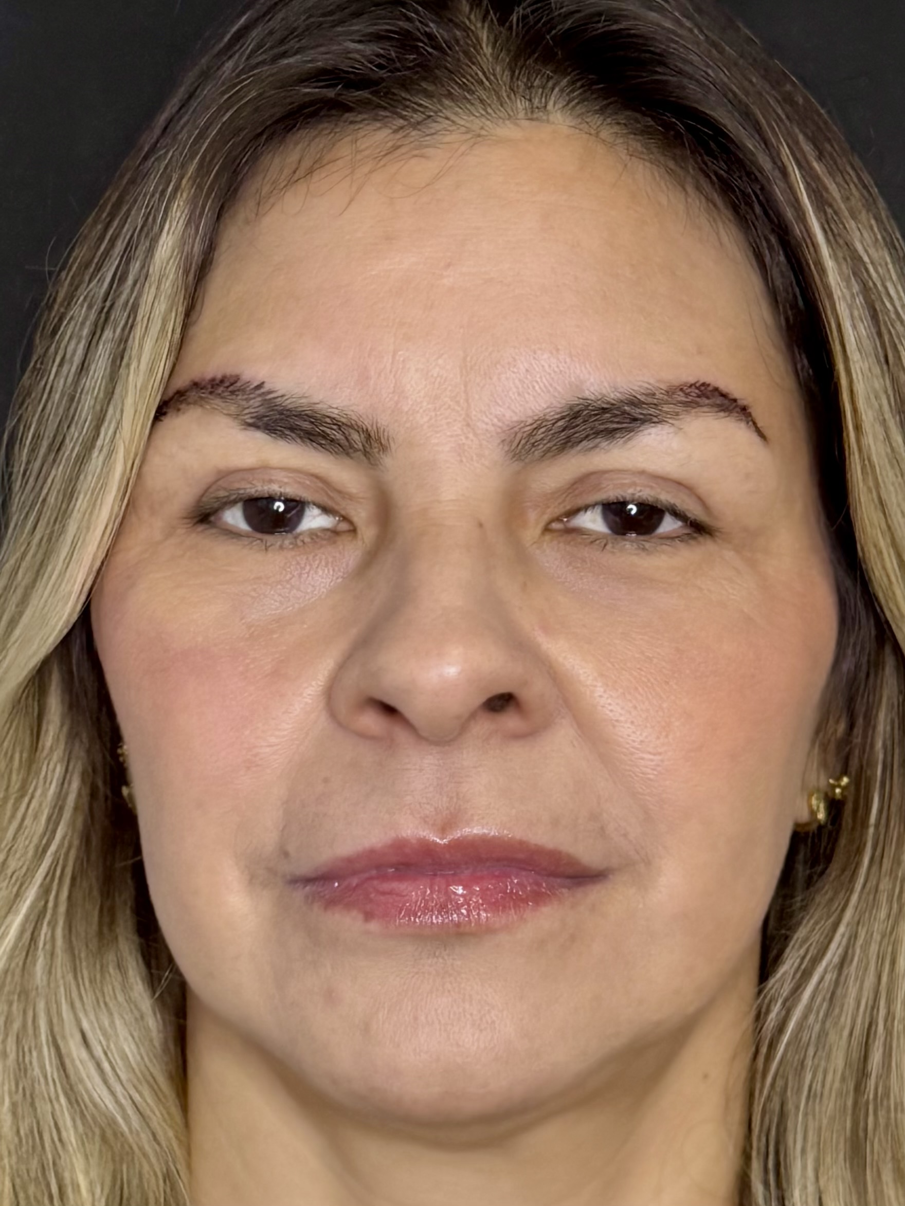 Resultado